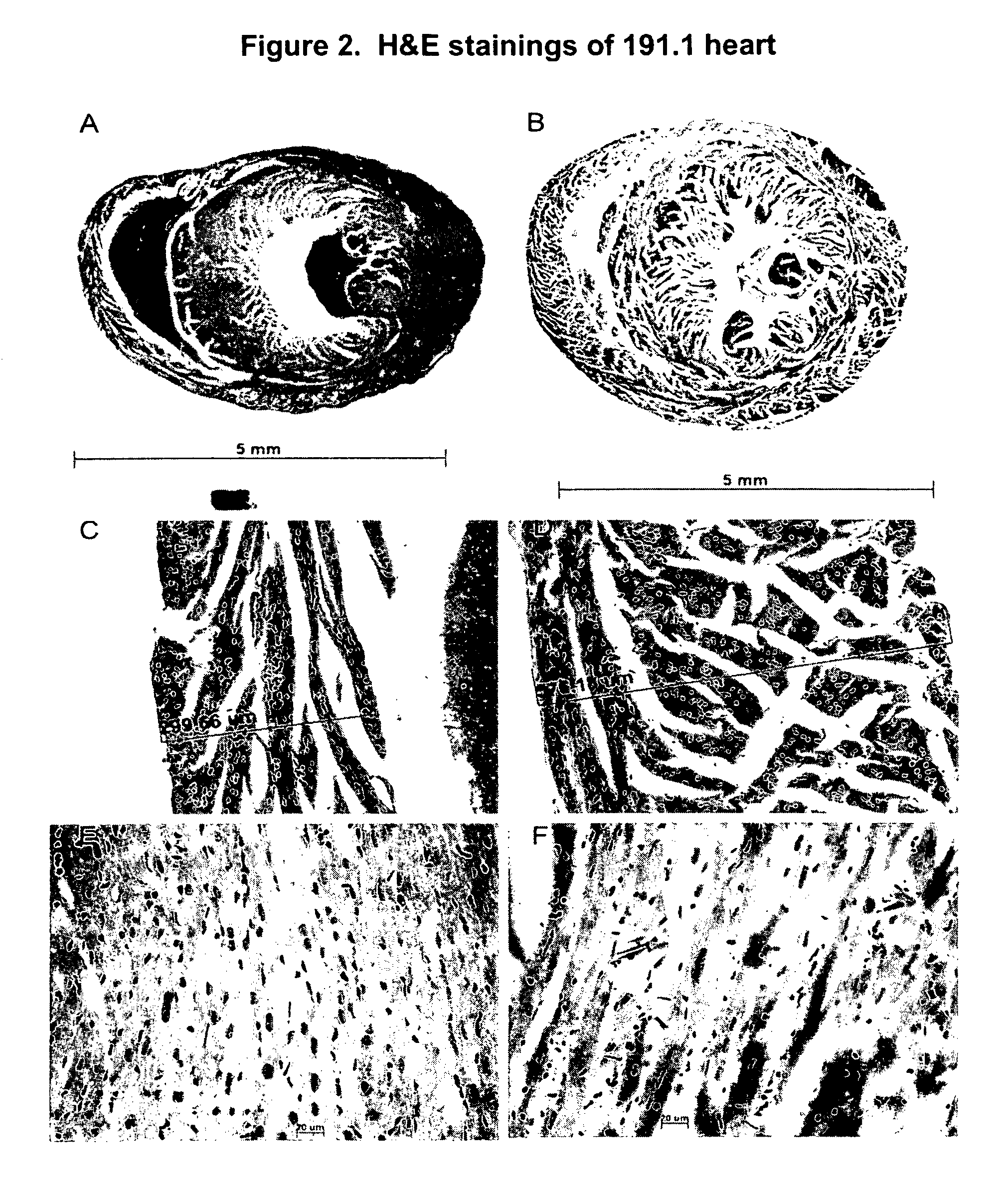 Mutant mice comprising a mutated type II procollagen alpha-1