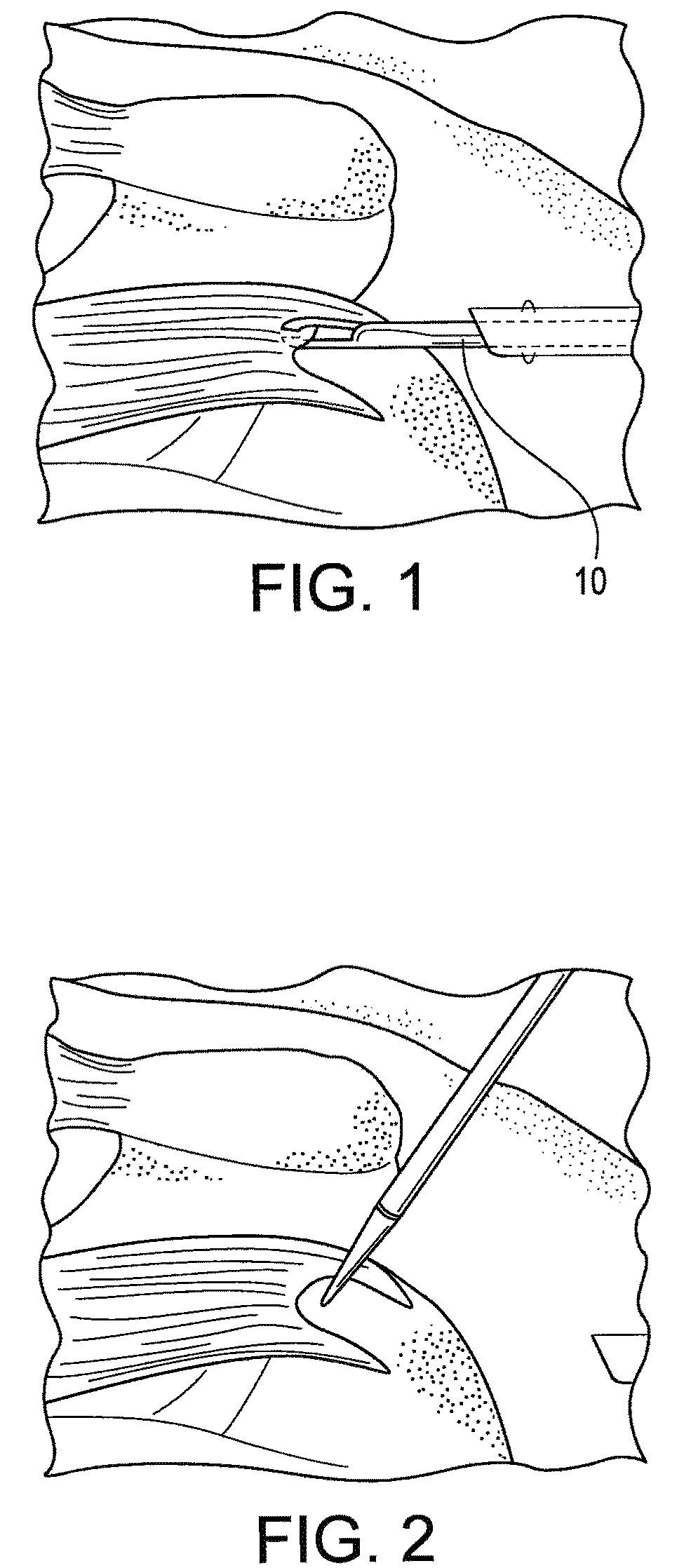 Swivel anchor for knotless fixation of tissue