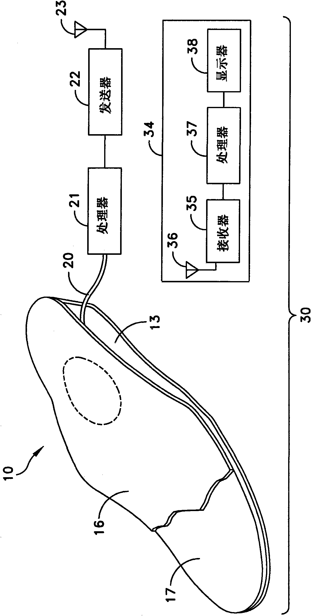 Intelligent orthotic insole