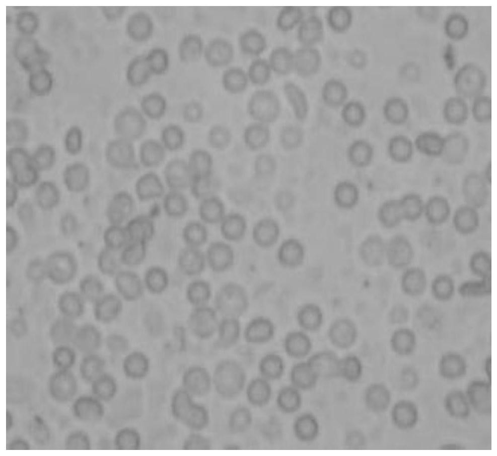 A cryopreservation solution for human spermatogonial stem cells