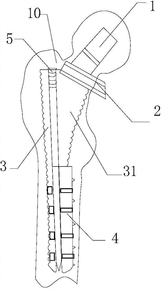 A biological artificial hip joint femoral stem