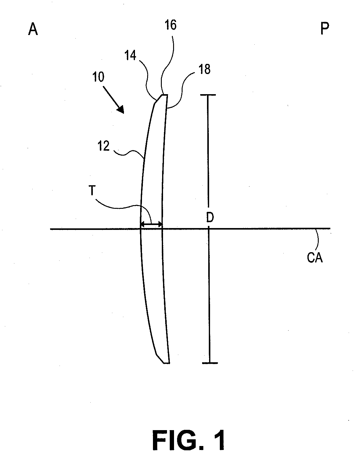 Corneal Inlay Design and Methods of Correcting Vision