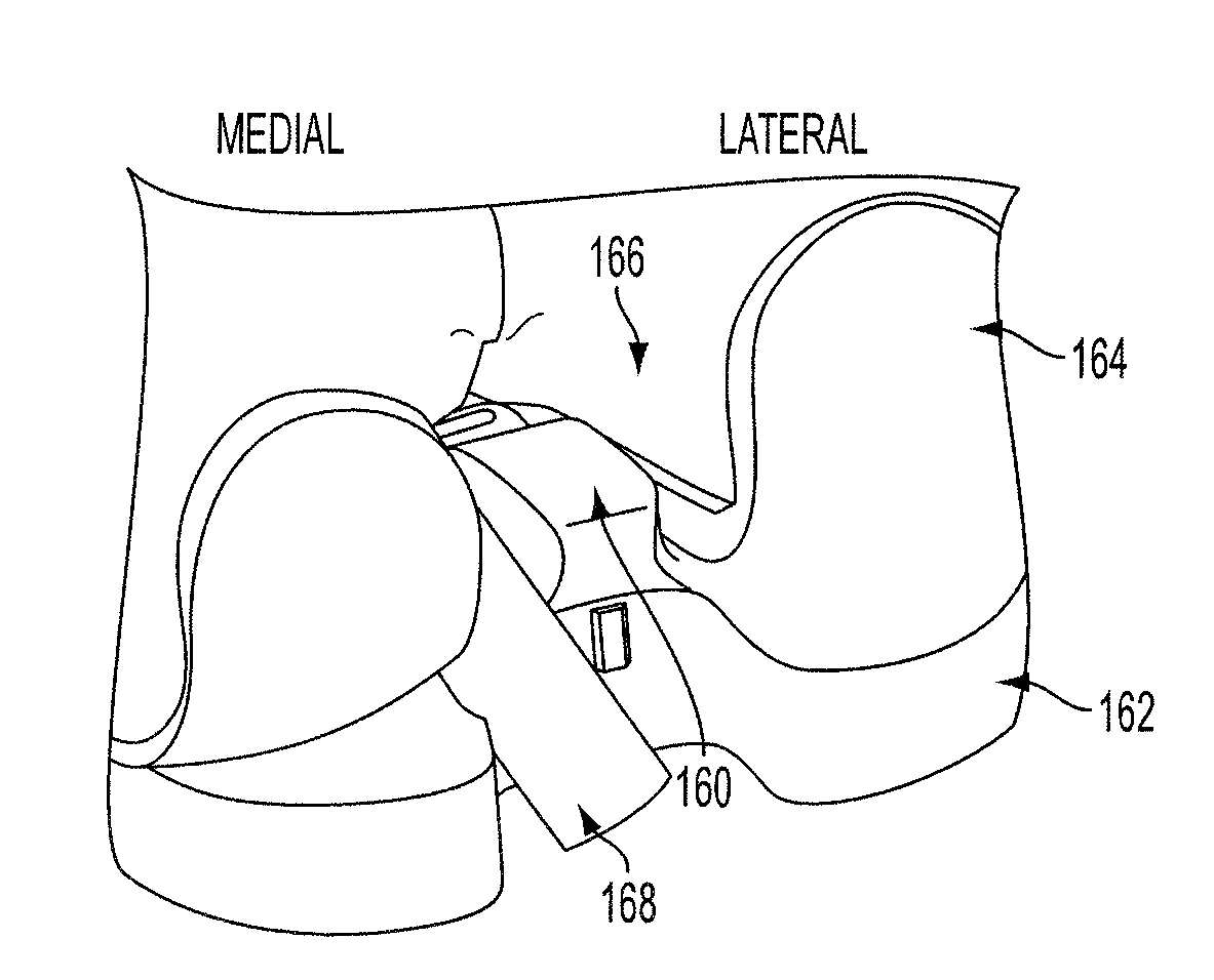 Methods and Devices for Knee Joint Replacement with Anterior Cruciate Ligament Substitution