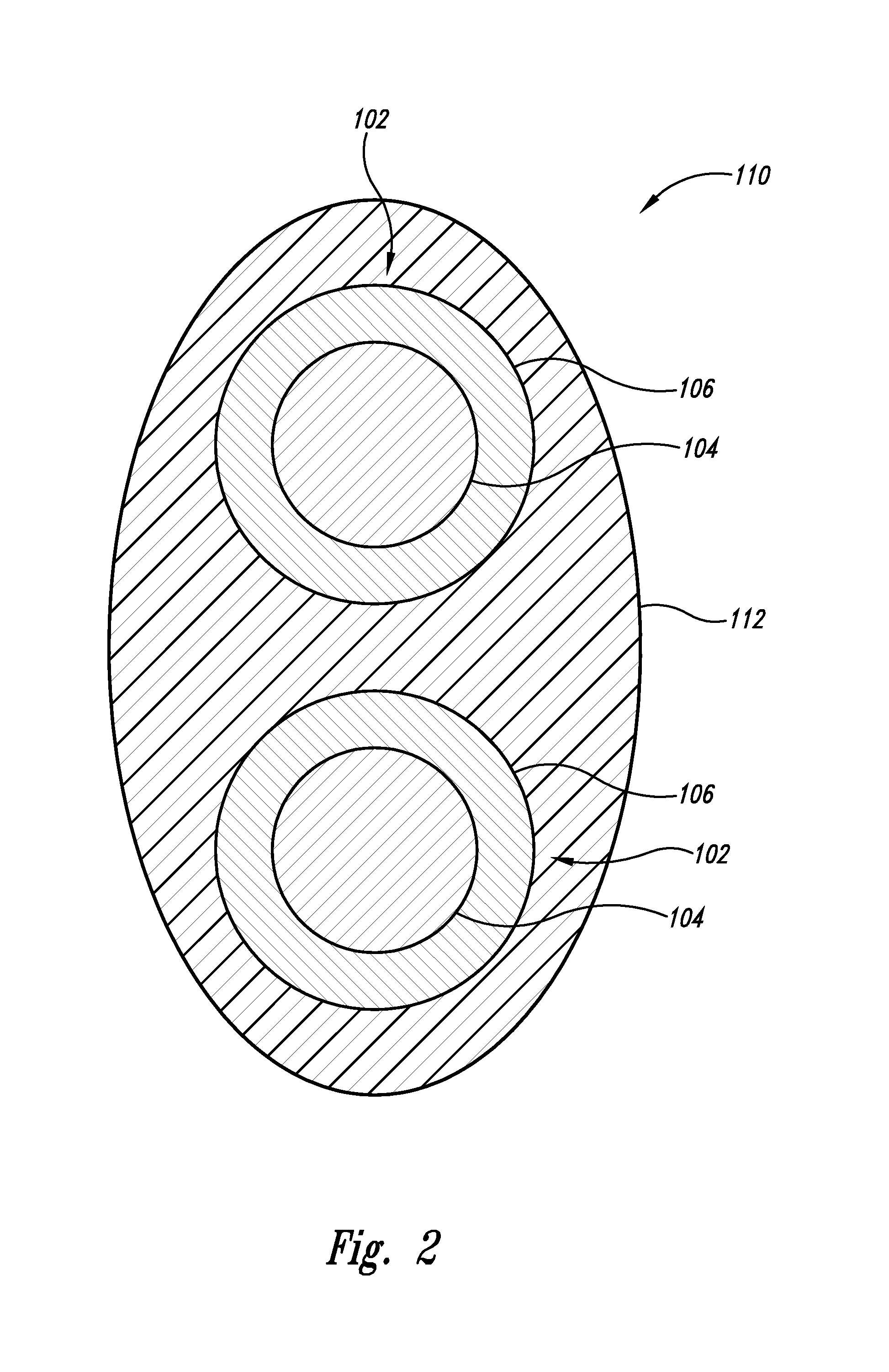 Enhanced implantable antenna system and method