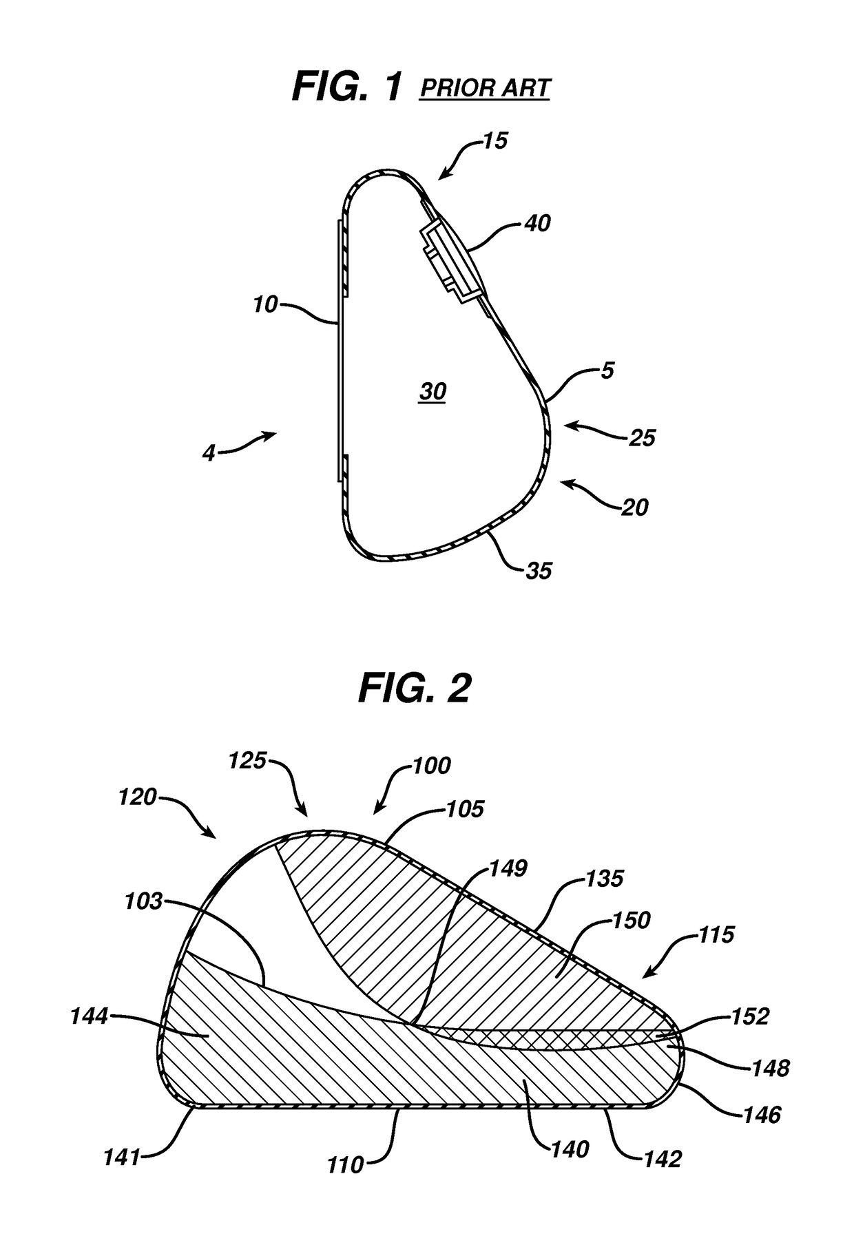 Directional tissue expander