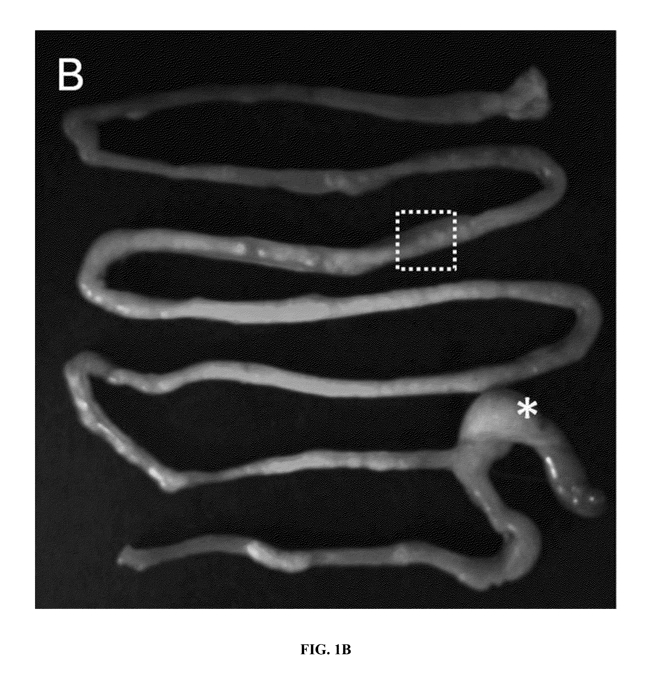 Methods and compositions for non-invasive, dynamic imaging of intestinal motility