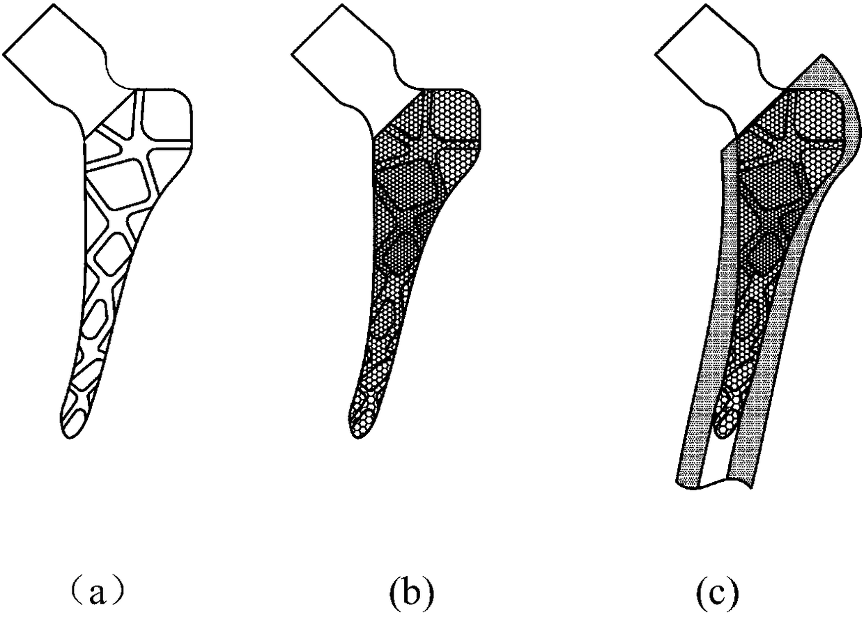 Variable modulus personalized femoral stem prosthesis and manufacturing method thereof