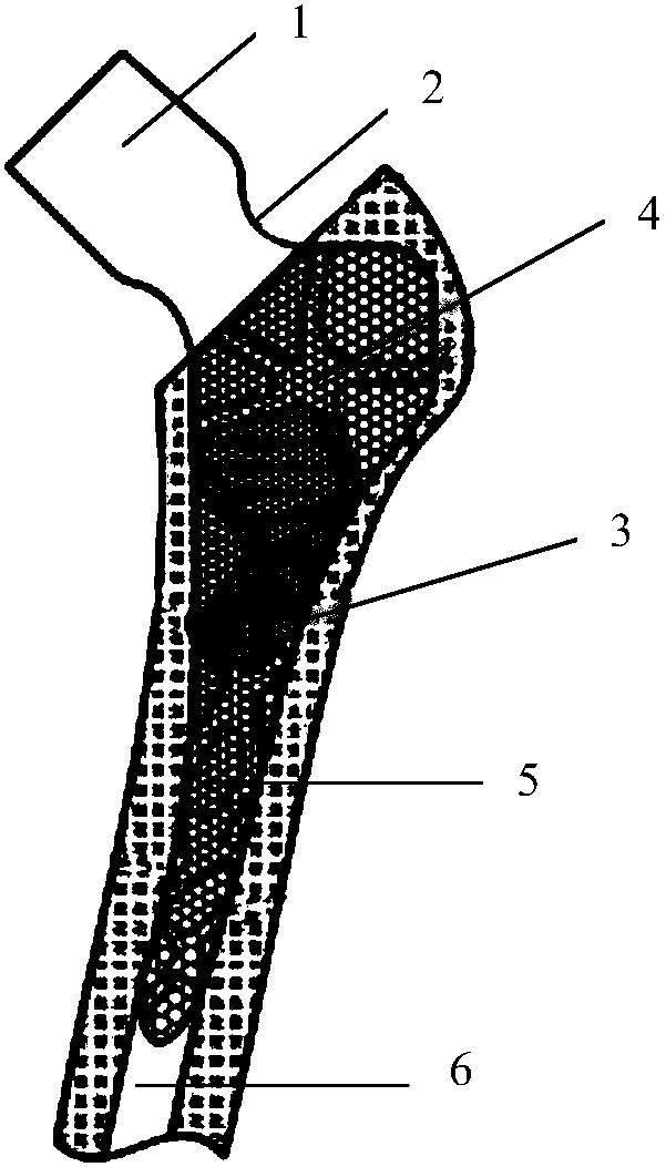 Variable modulus personalized femoral stem prosthesis and manufacturing method thereof