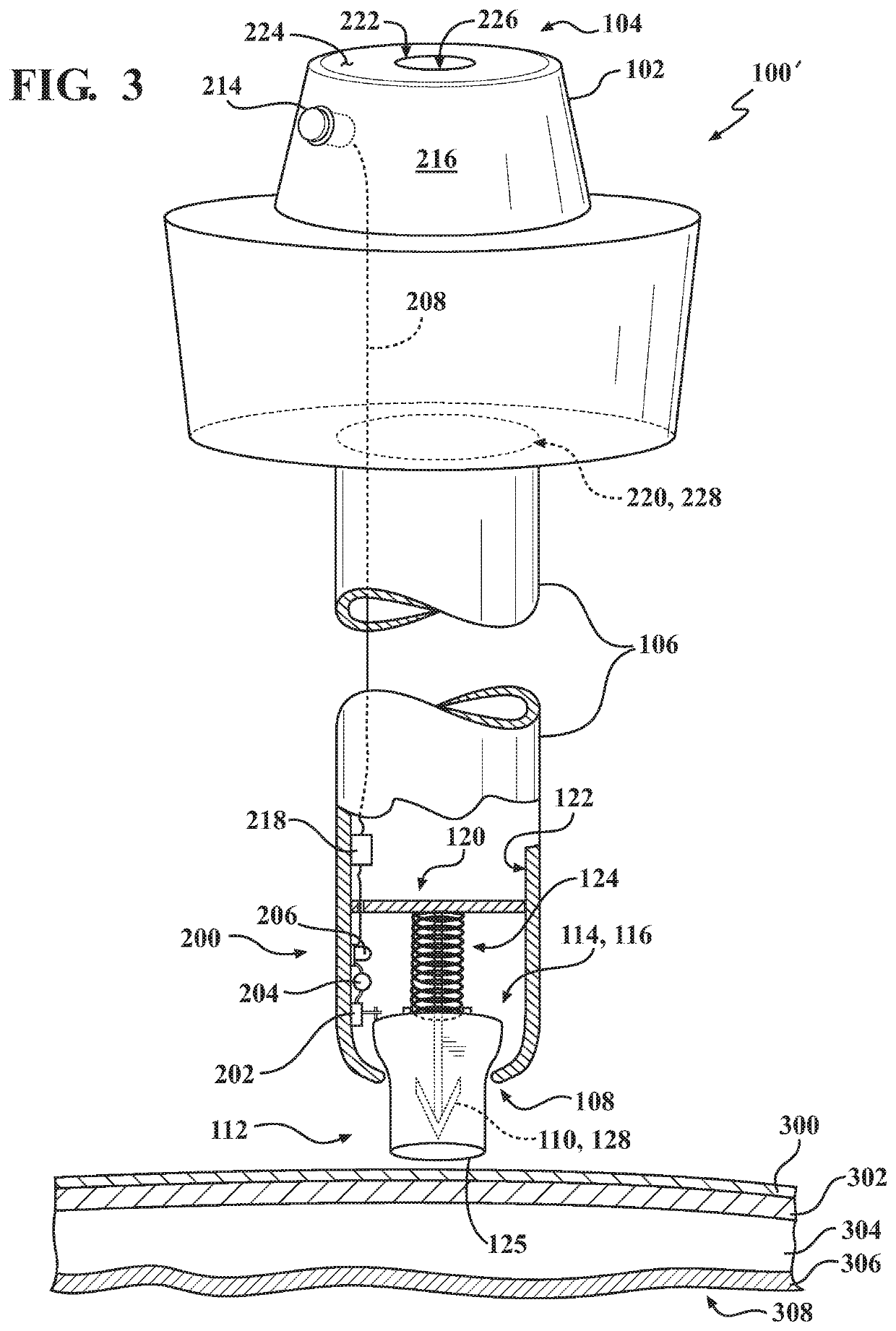 Trocar assemblies with movable atraumatic tip and methods for use