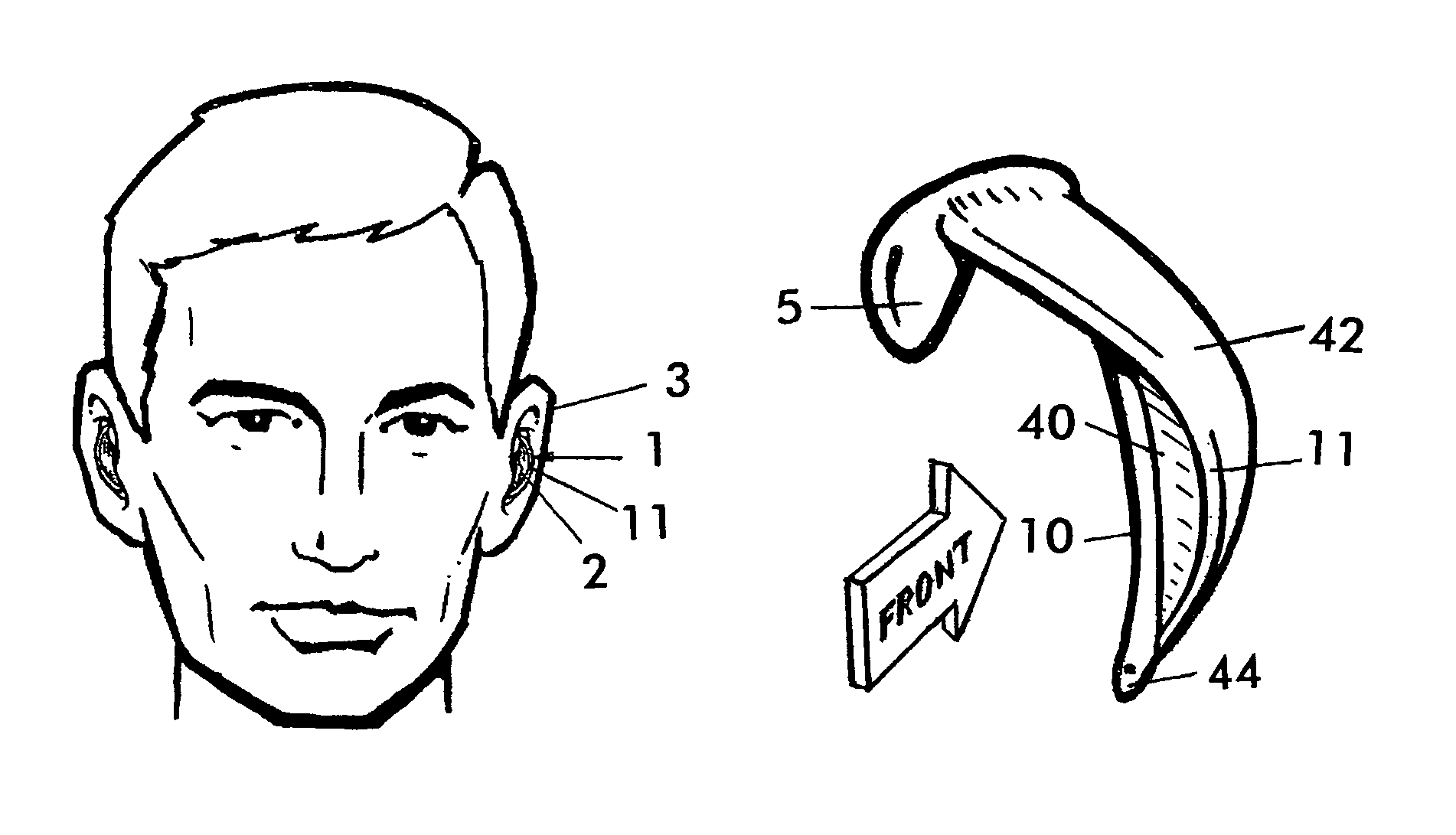 External ear insert for hearing comprehension enhancement