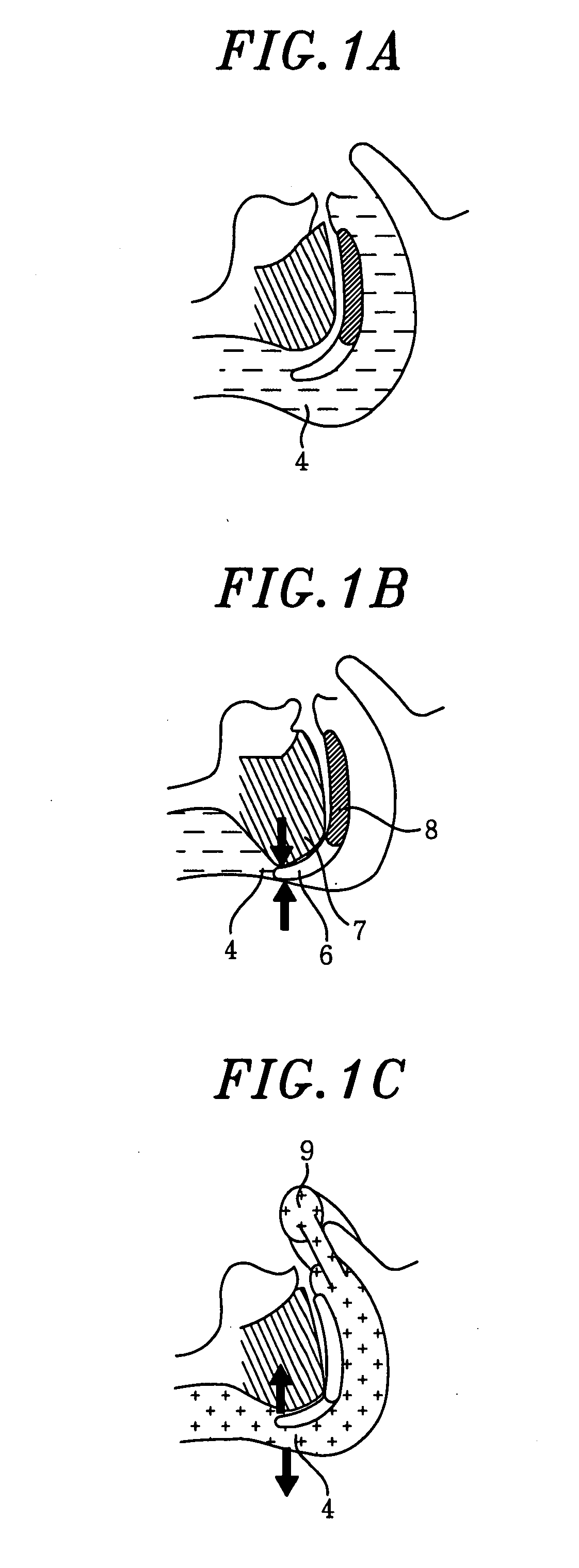 Apparatus for preventing sleeping respiratory obstruction