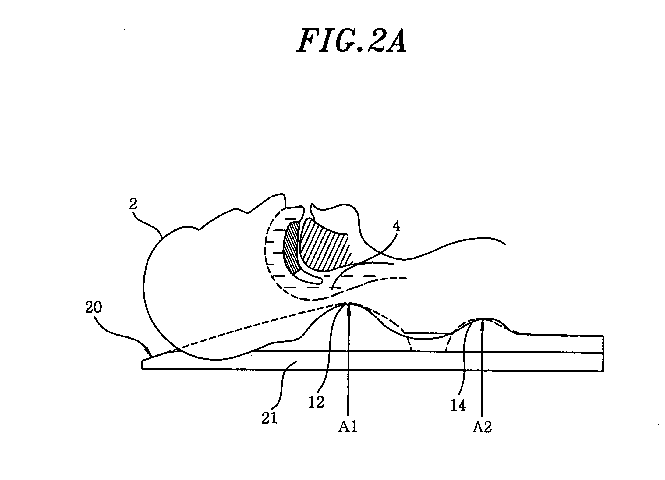 Apparatus for preventing sleeping respiratory obstruction