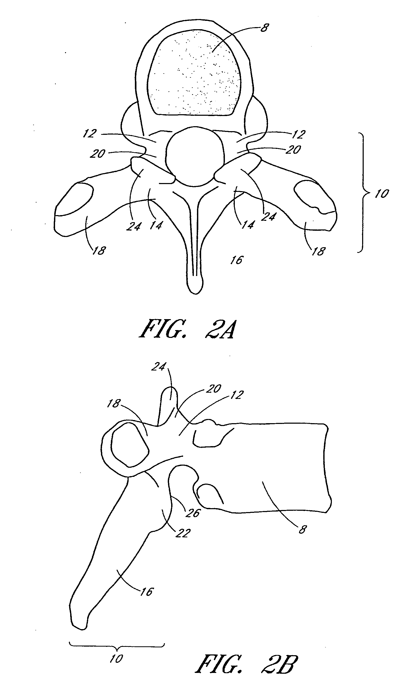 Flanged interbody fusion device with oblong fastener apertures