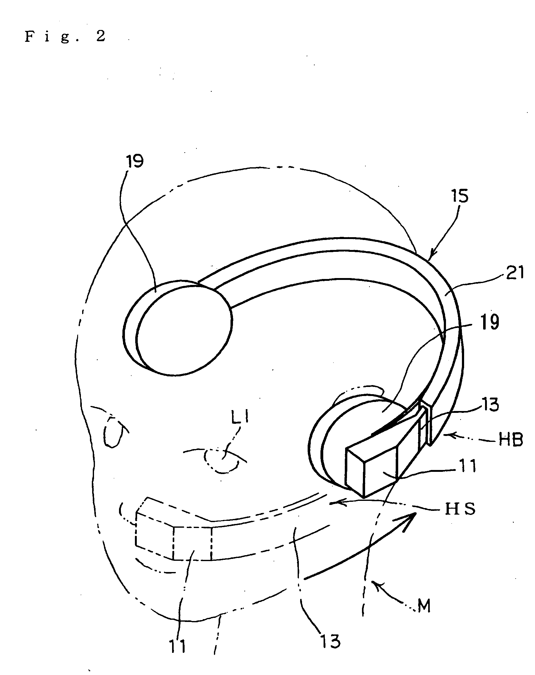 Head mounted display