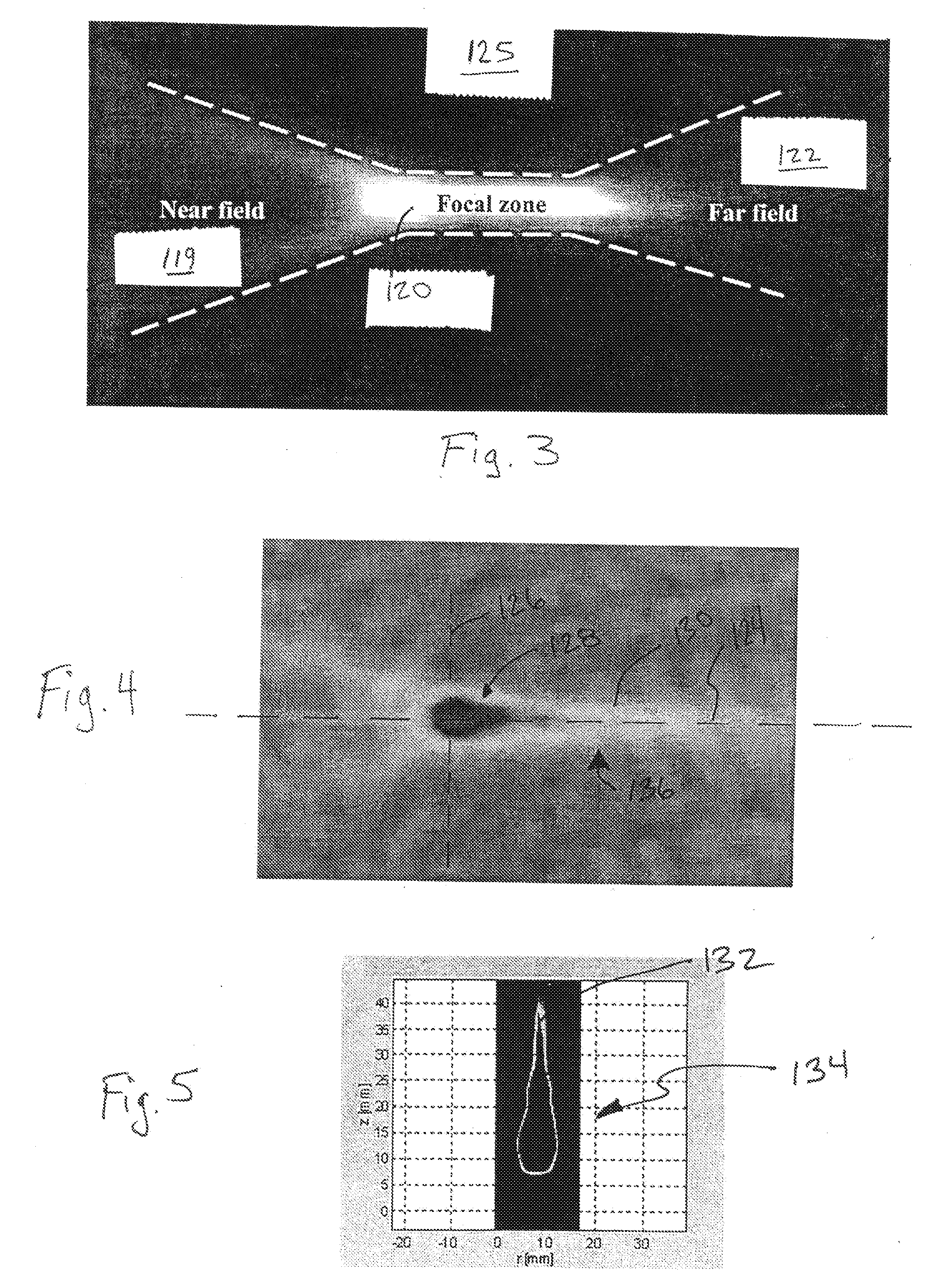 Focused ultrasound system with far field tail suppression