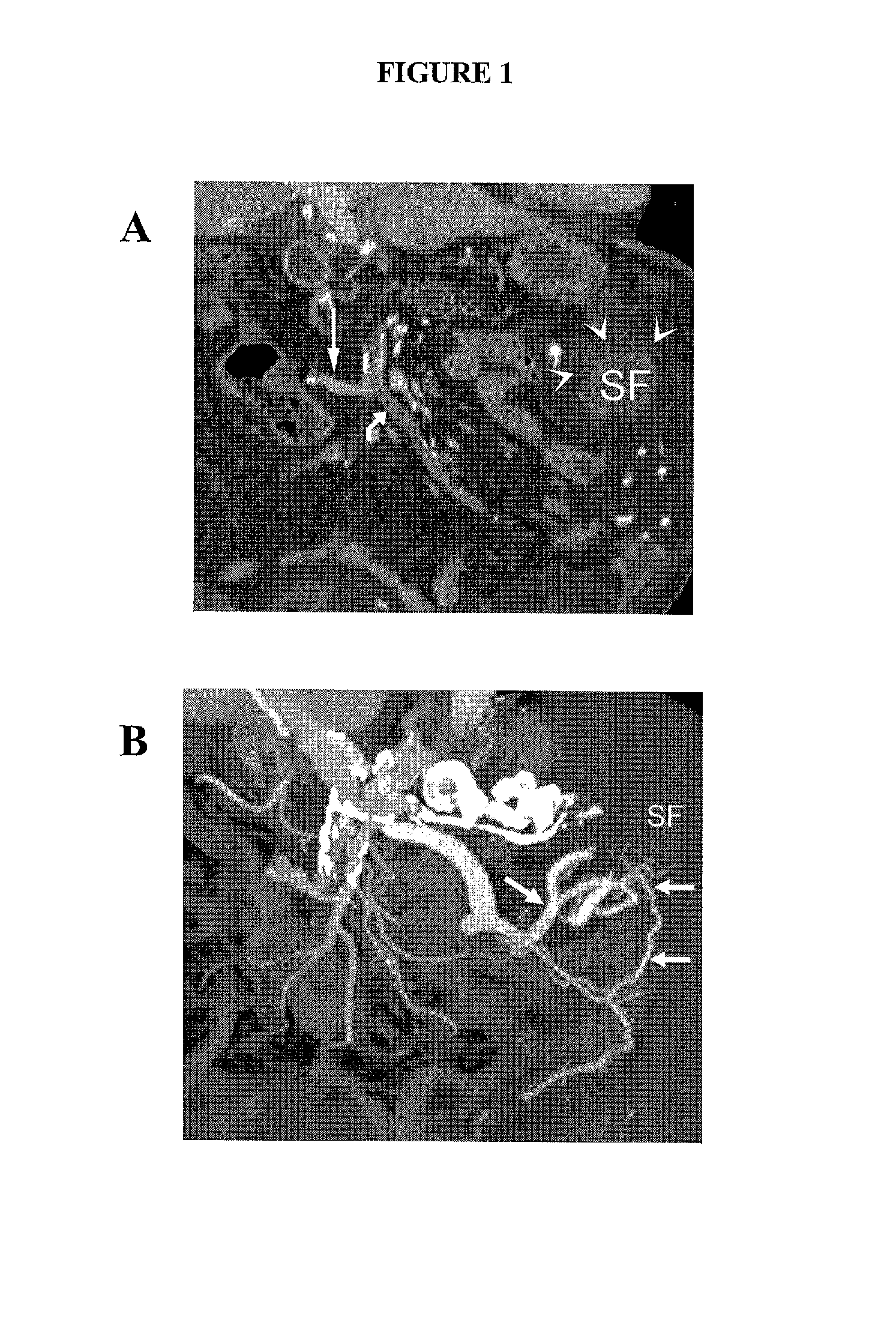 Targeted treatment of anerobic cancer