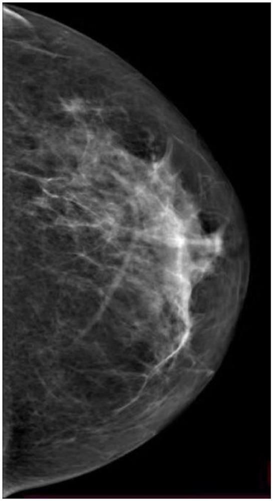 Application of CEM in mammary duct angiography and verification method