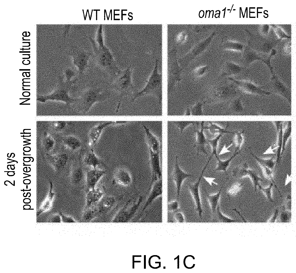 Mitochondrial protease oma1 as a marker for breast cancer