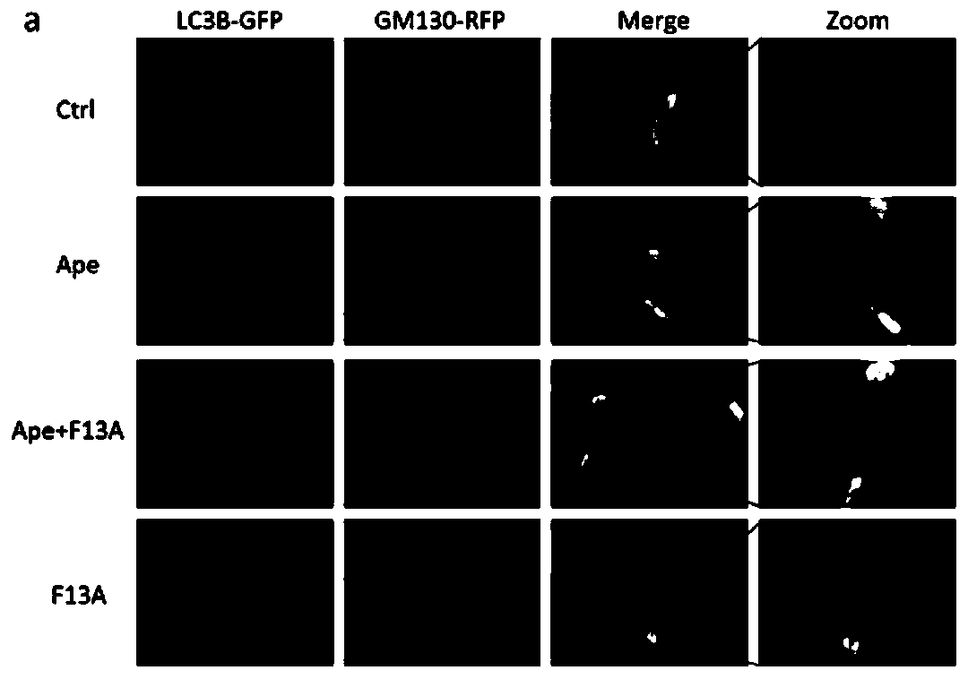Application of siRNA-GOLPH3 in preparing medicine for preventing or treating cardiomyocyte hypertrophy