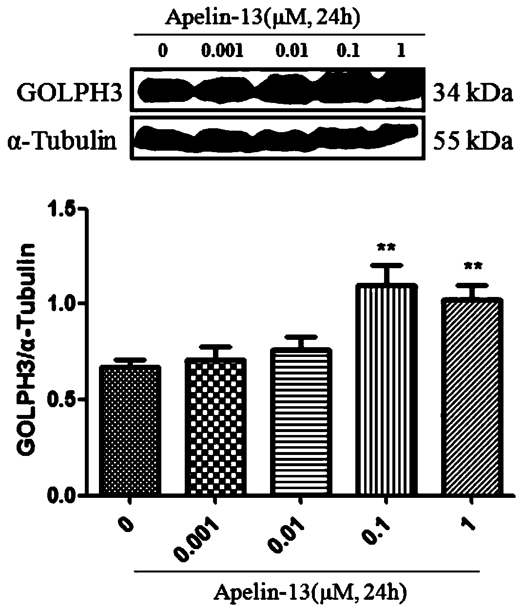 Application of siRNA-GOLPH3 in preparing medicine for preventing or treating cardiomyocyte hypertrophy