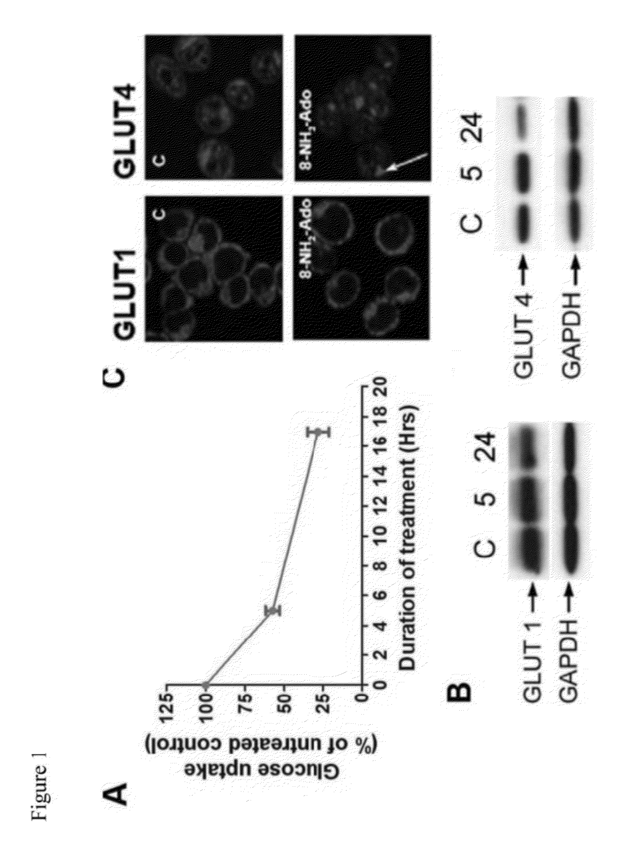 Methods of Treating Cancer with Glut Inhibitors