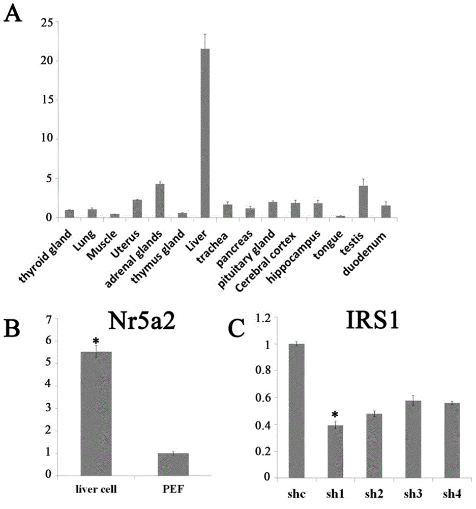 A kind of shrna that suppresses irs1 gene expression and application