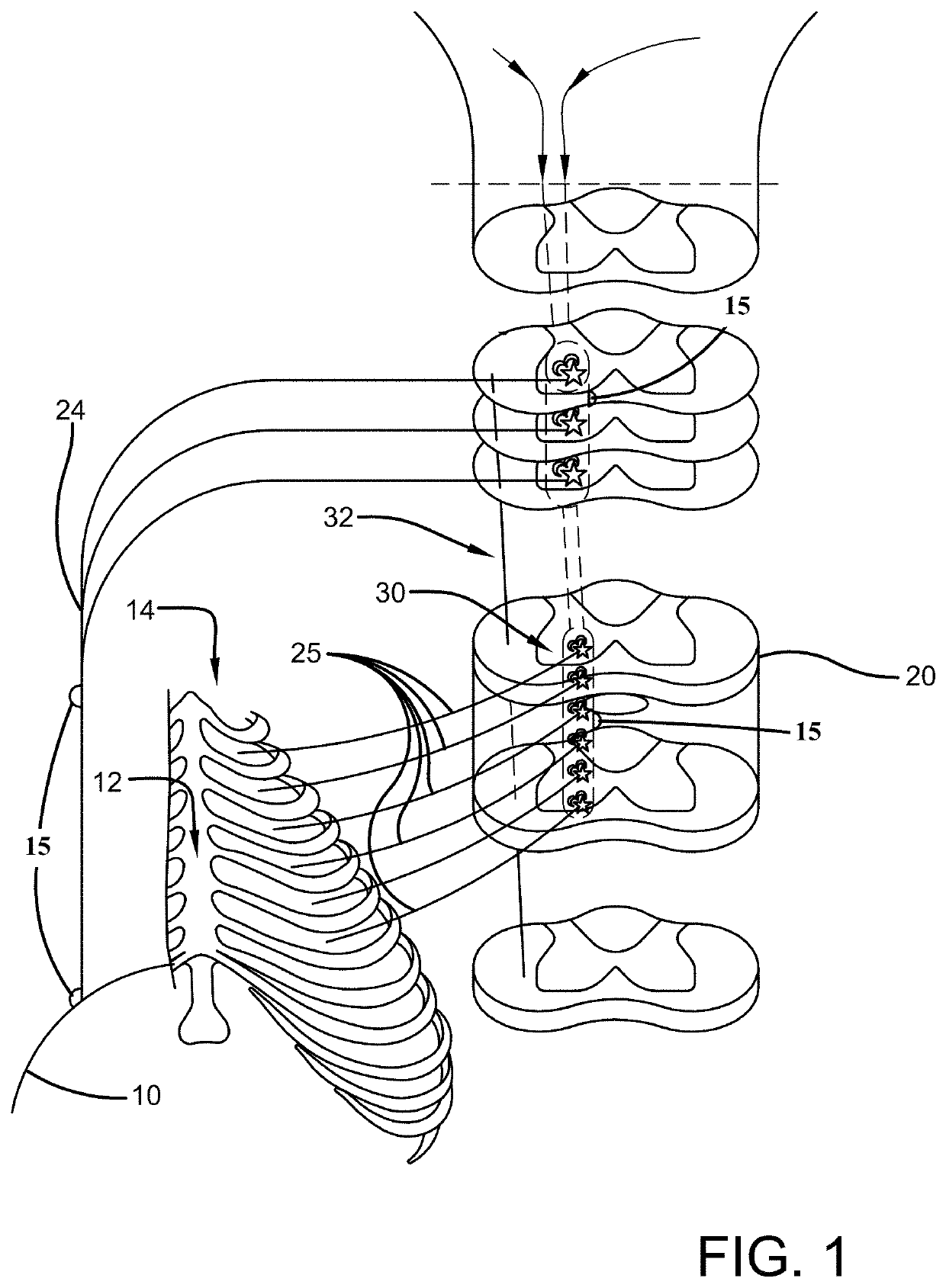 System and method for activating inspiratory and expiratory muscle function