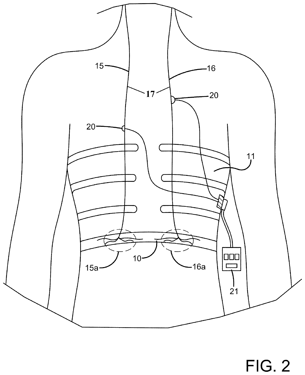 System and method for activating inspiratory and expiratory muscle function