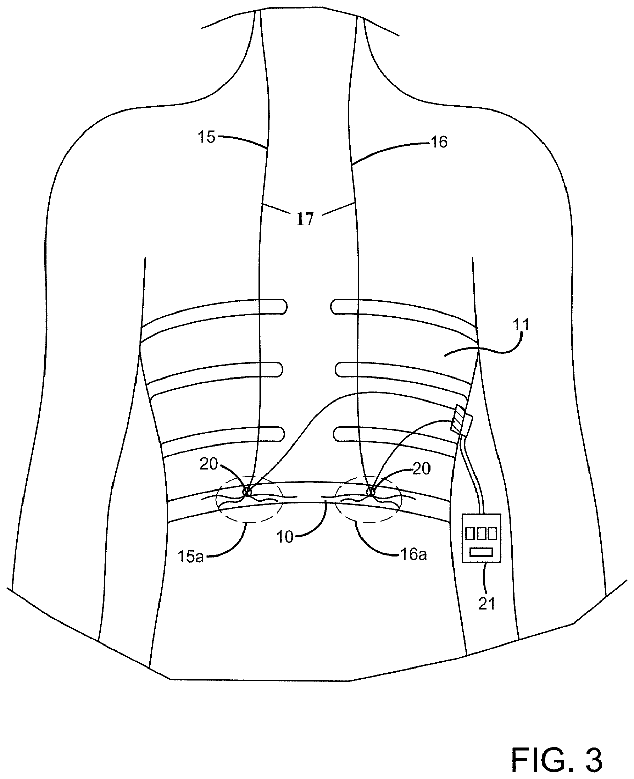 System and method for activating inspiratory and expiratory muscle function