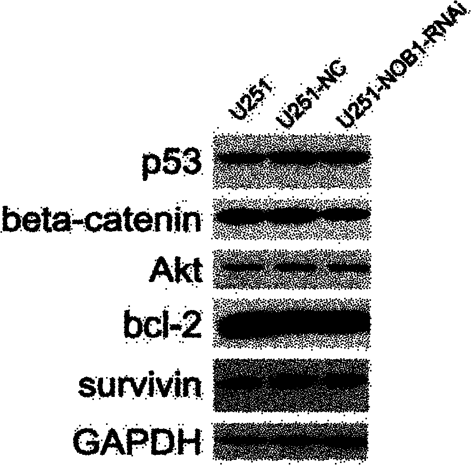 Application of NOB1 gene in treating brain glioma disease