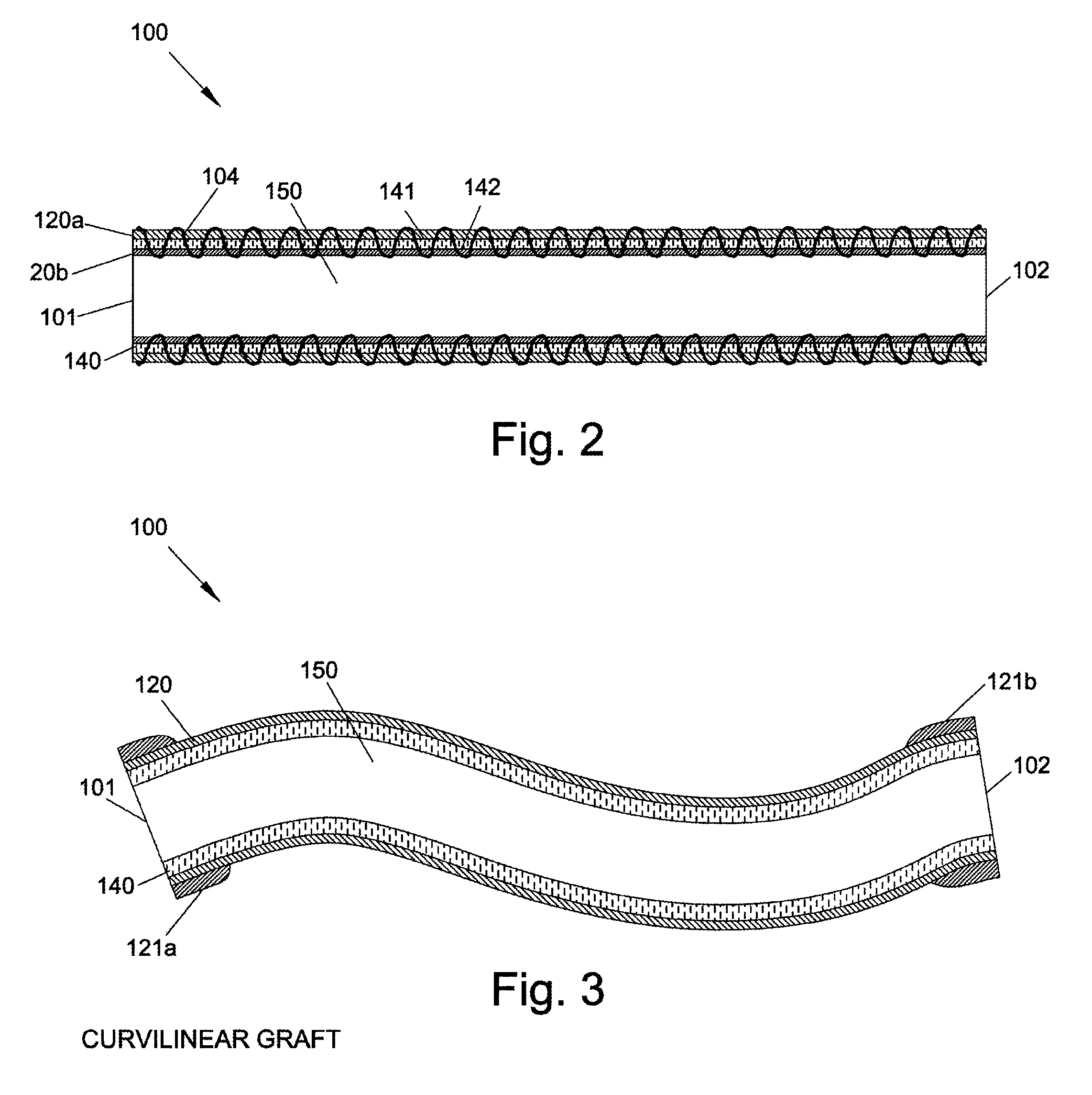 Graft devices and methods of fabrication