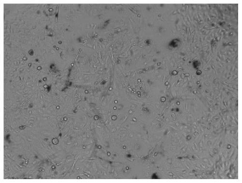 Rapid quantitative senescence cell detection method based on senescence-associated beta-galactosidase