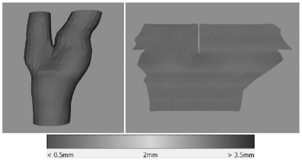Carotid artery ultrasonic image processing method and device, storage medium and ultrasonic equipment