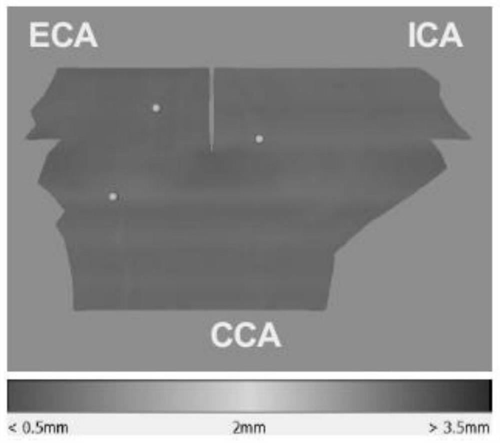 Carotid artery ultrasonic image processing method and device, storage medium and ultrasonic equipment