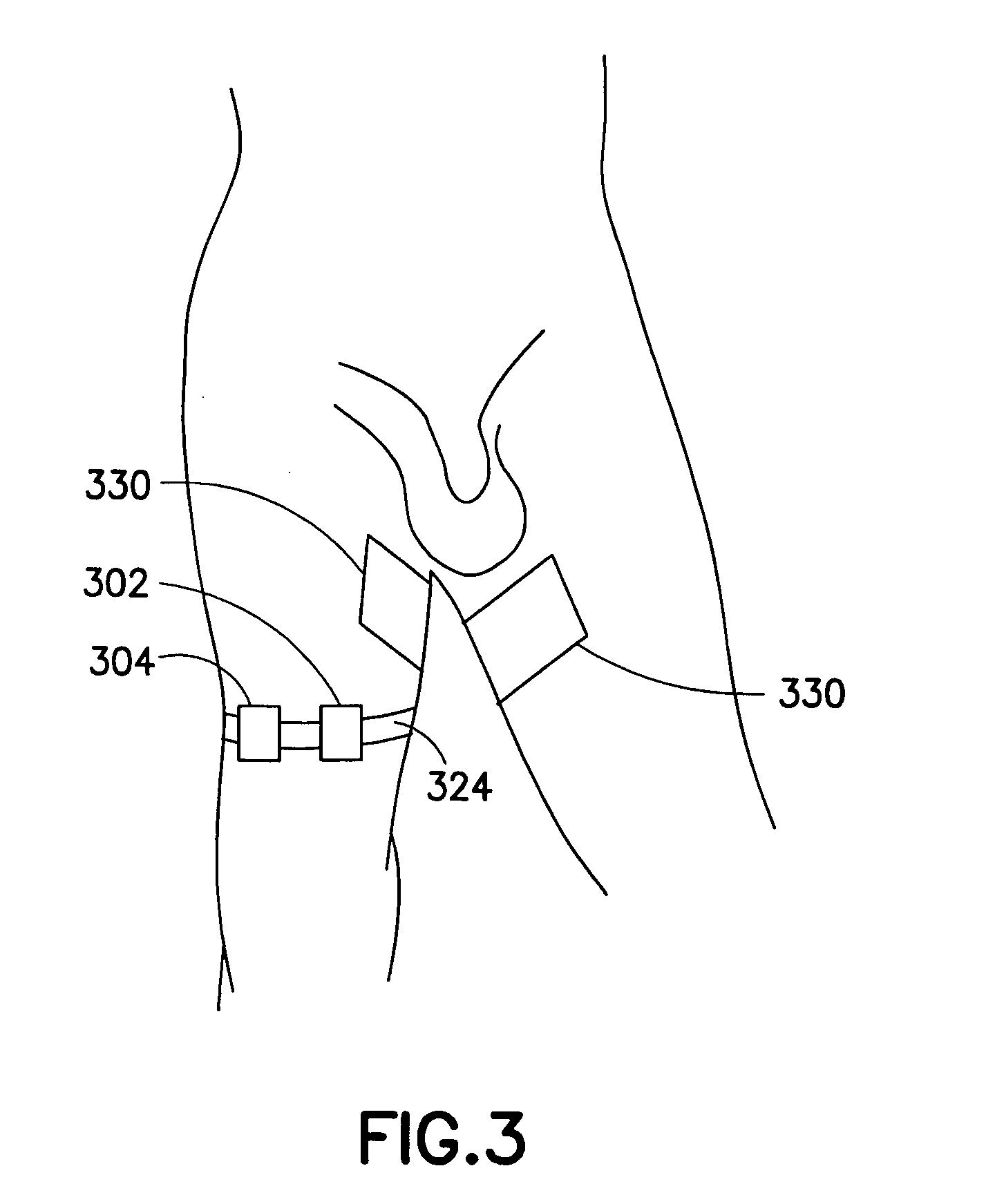 Method and apparatus for potentiating penile erection utilizing ultraweak electromagnetic field of very low frequency