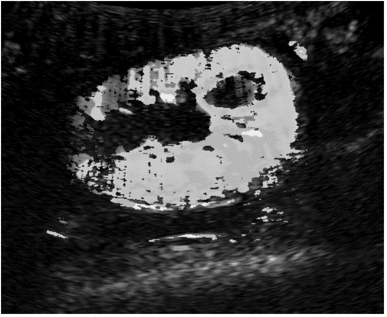 Ultrasonographic perfusion parameter imaging method based on single-pixel TIC source