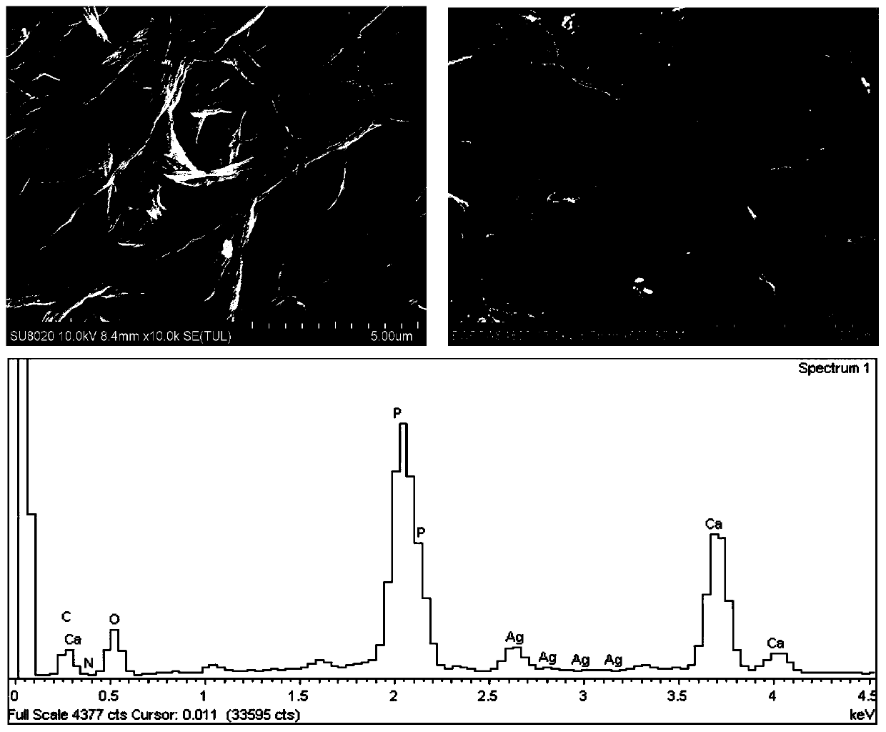 Silver nanowire-mineralized collagen co-assembled bionic stent and production method and application thereof