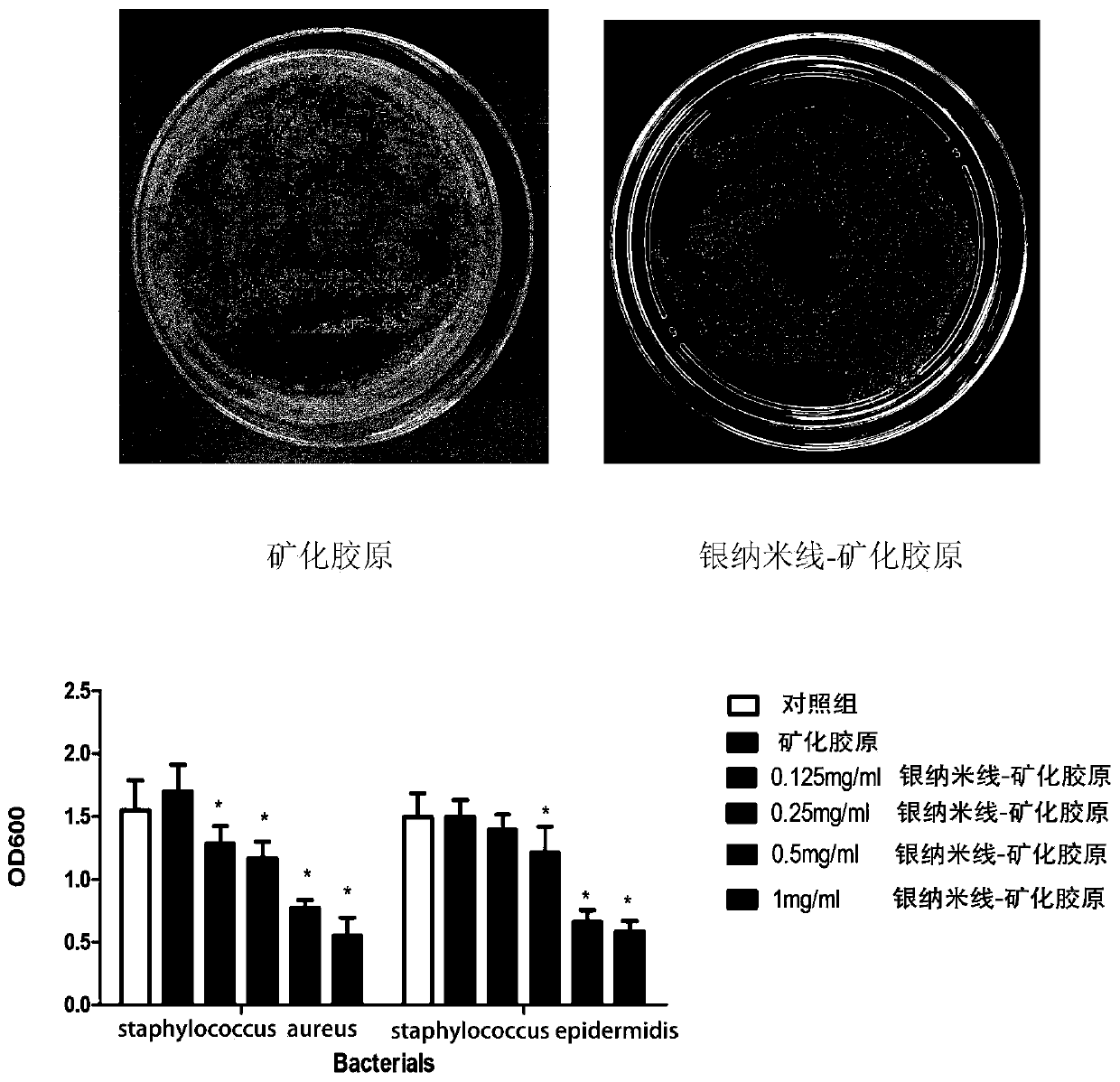 Silver nanowire-mineralized collagen co-assembled bionic stent and production method and application thereof