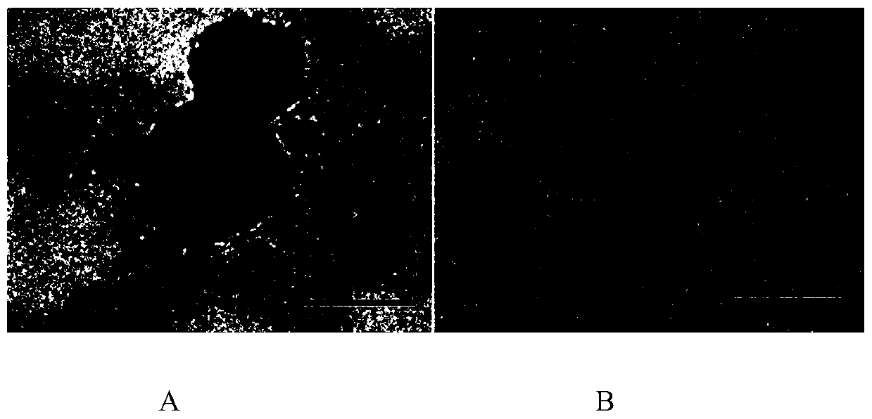 A biomimetic intelligent drug carrier for ischemic stroke targeting erythrocyte membrane and its preparation method