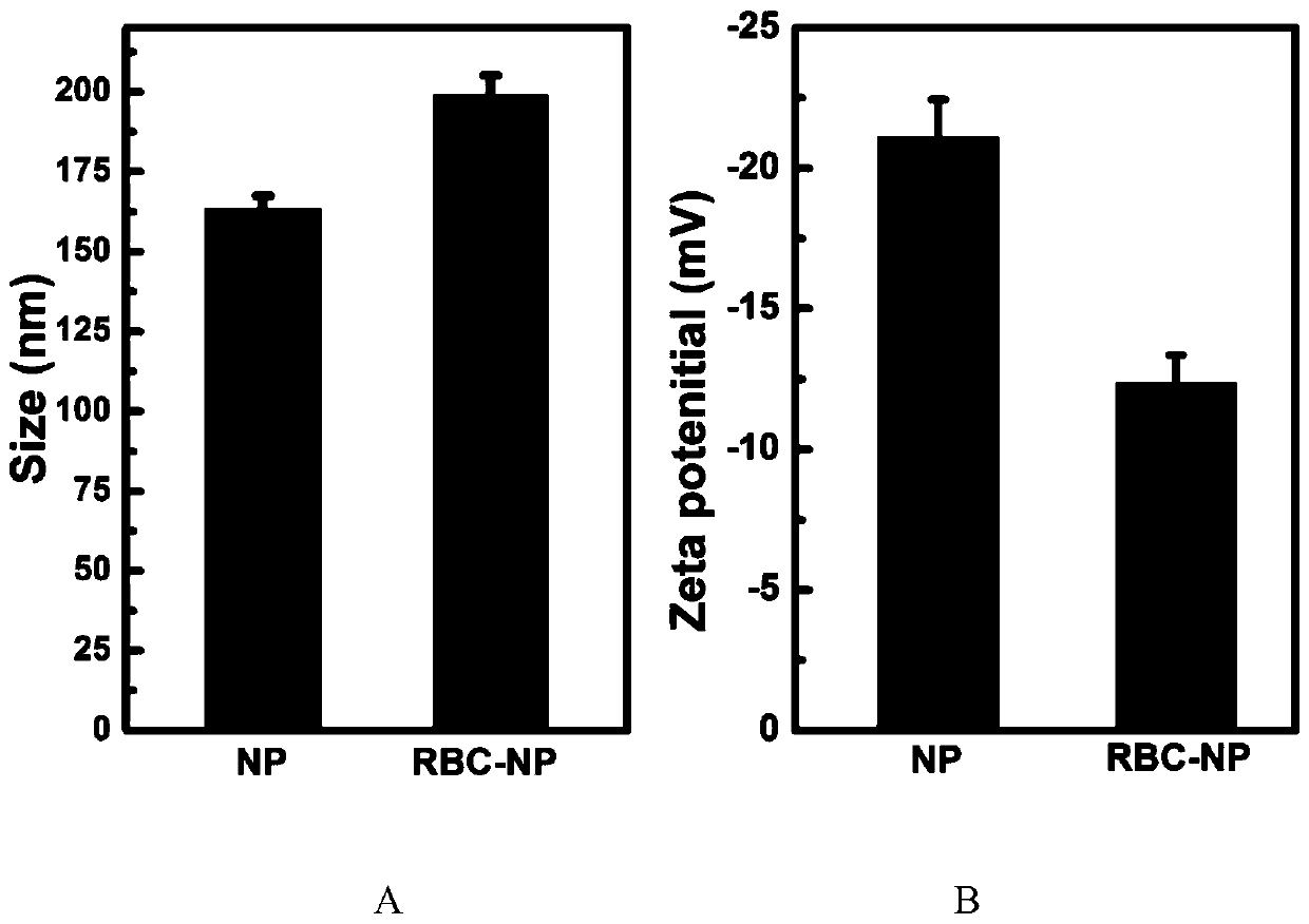 A biomimetic intelligent drug carrier for ischemic stroke targeting erythrocyte membrane and its preparation method