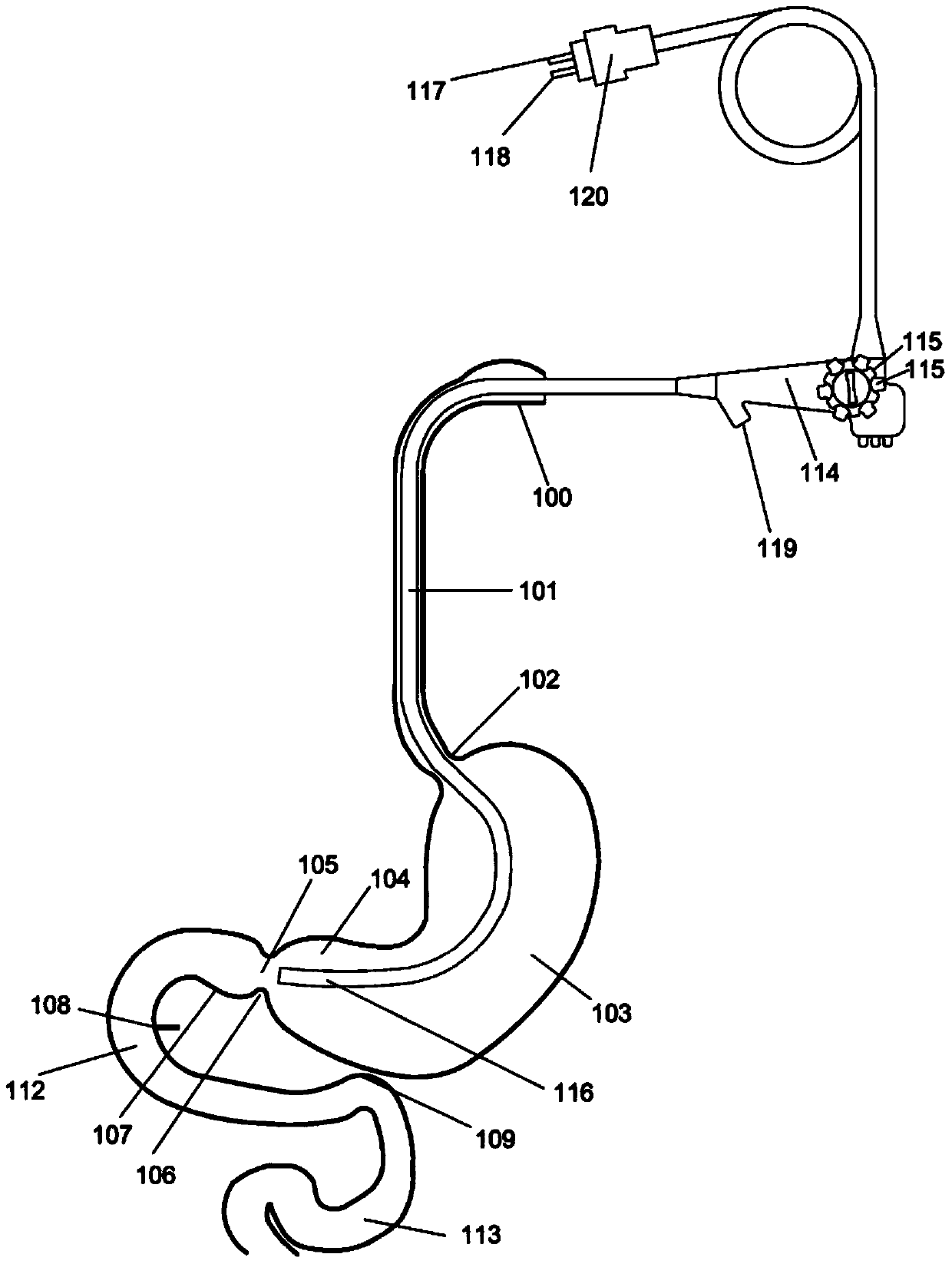 Anchors and methods for intestinal bypass sleeves