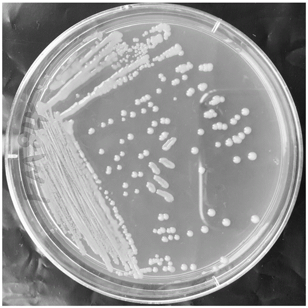 Klebsiella pneumoniae, bacterium agent of klebsiella pneumoniae and preparation method and application