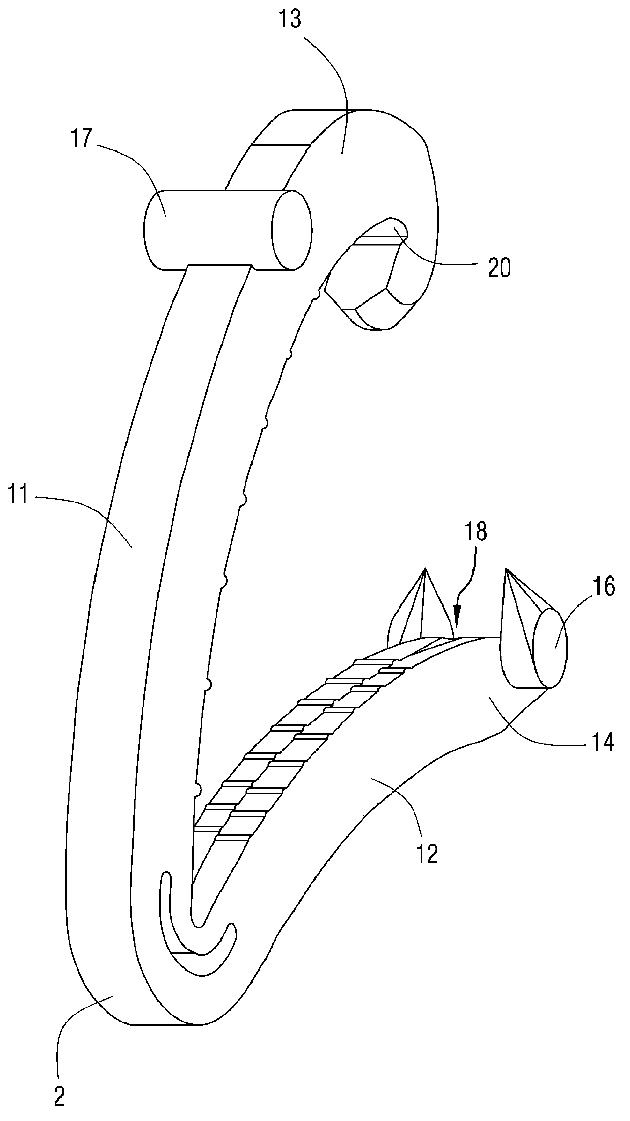 Ligation clip