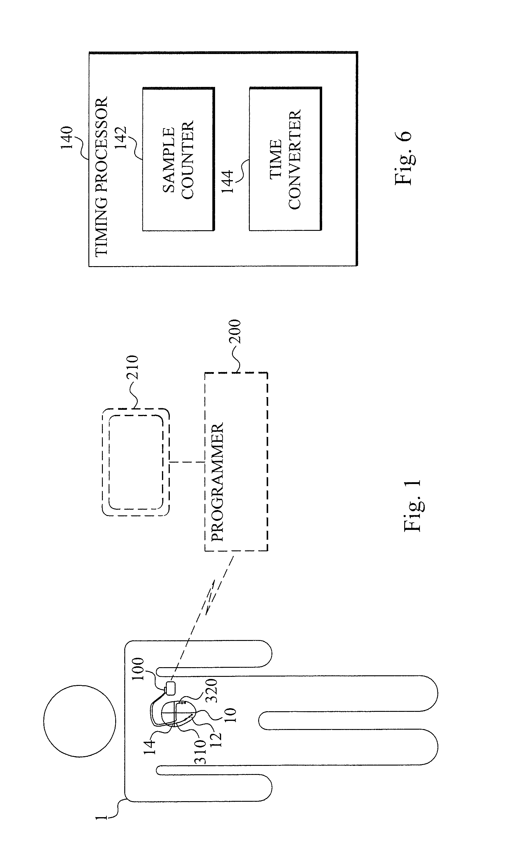 Heart failure detecting medical device