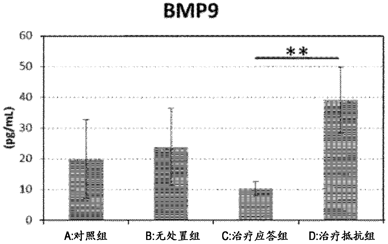 Method for predicting efficacy of Anti-vegf drug treatment for exudative age-related macular degeneration