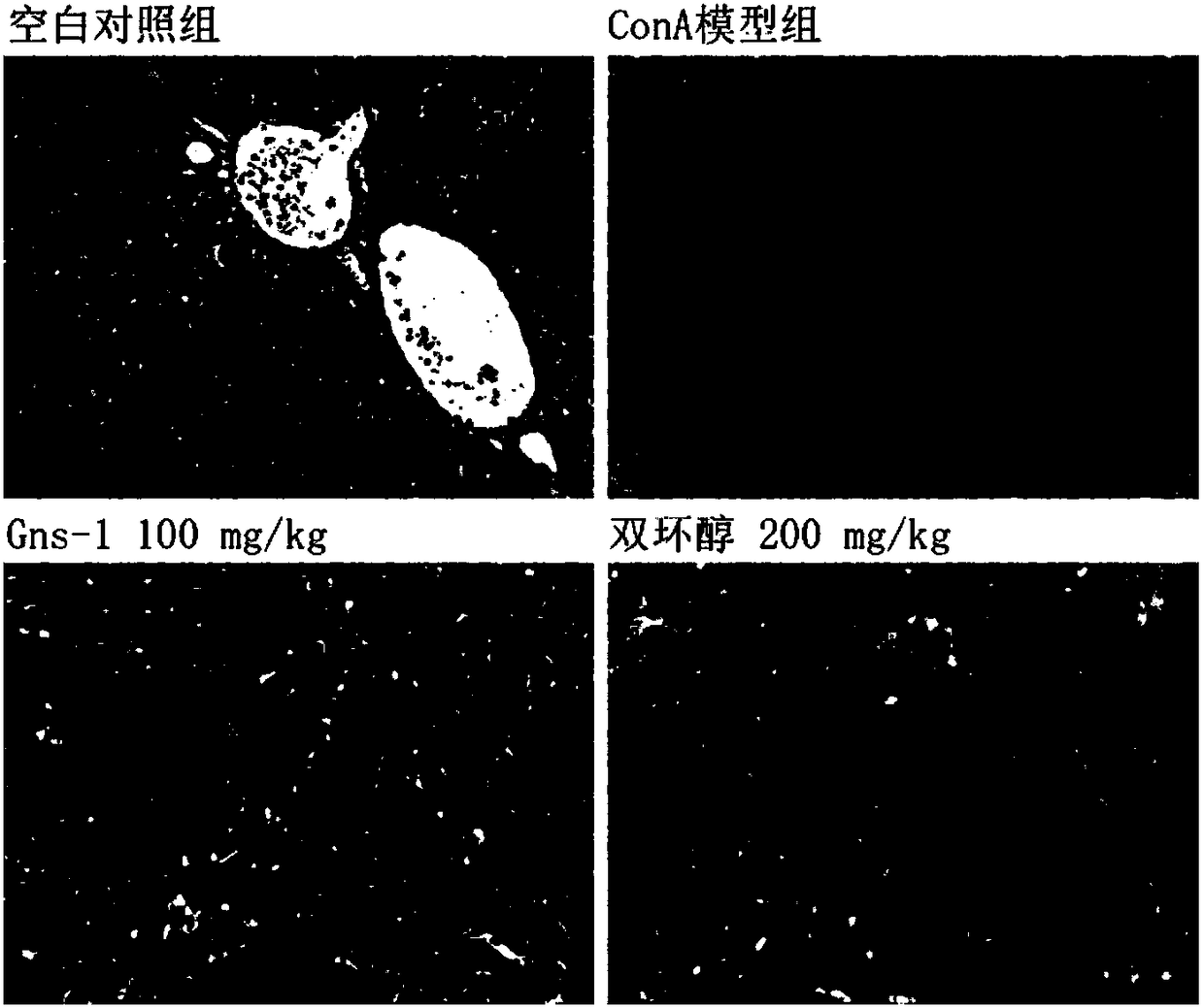 Application of toluylene dimer in preparing medicine for treating liver related diseases