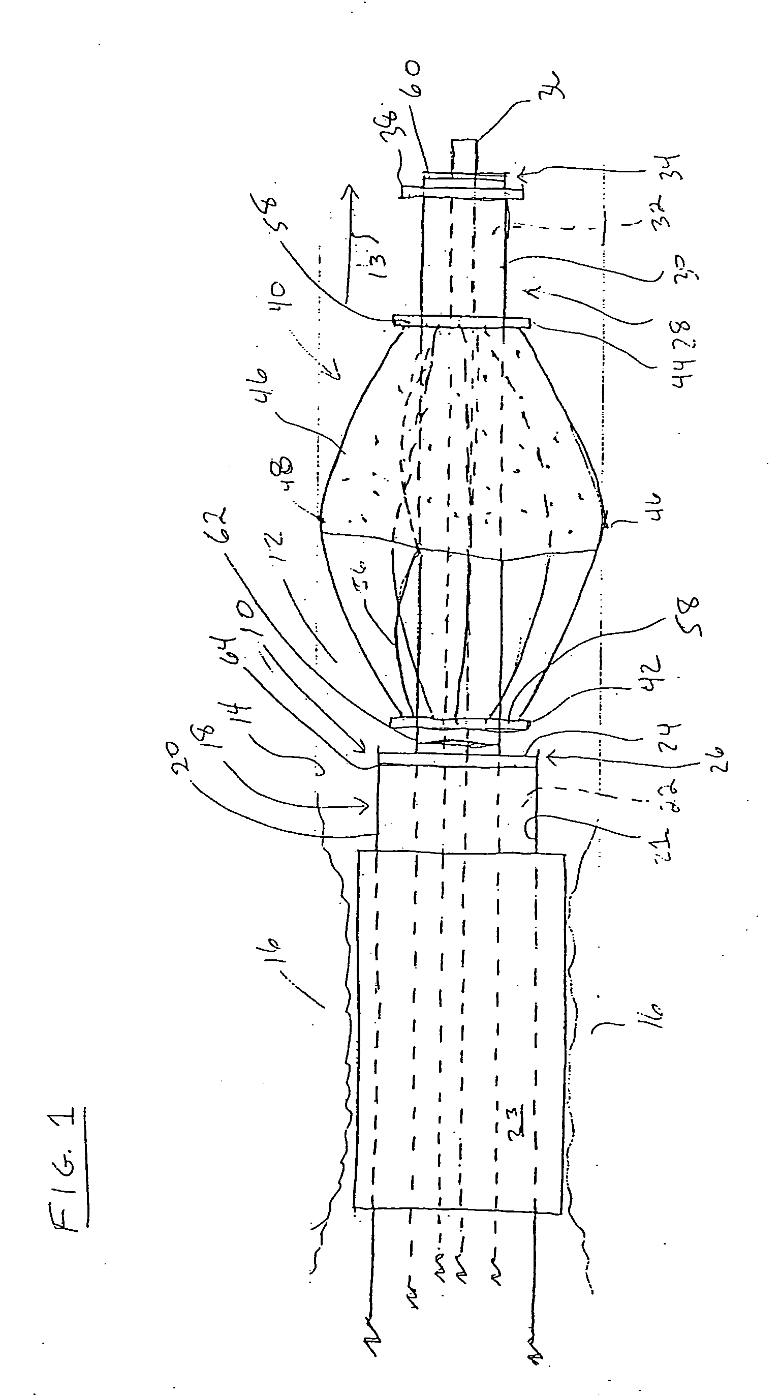 Apparatus for trapping emboli