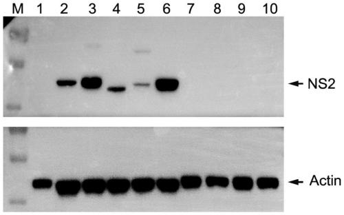 Monoclonal antibody of specificity detection of bluetongue viruses and hybridoma cell strain and application of monoclonal antibody