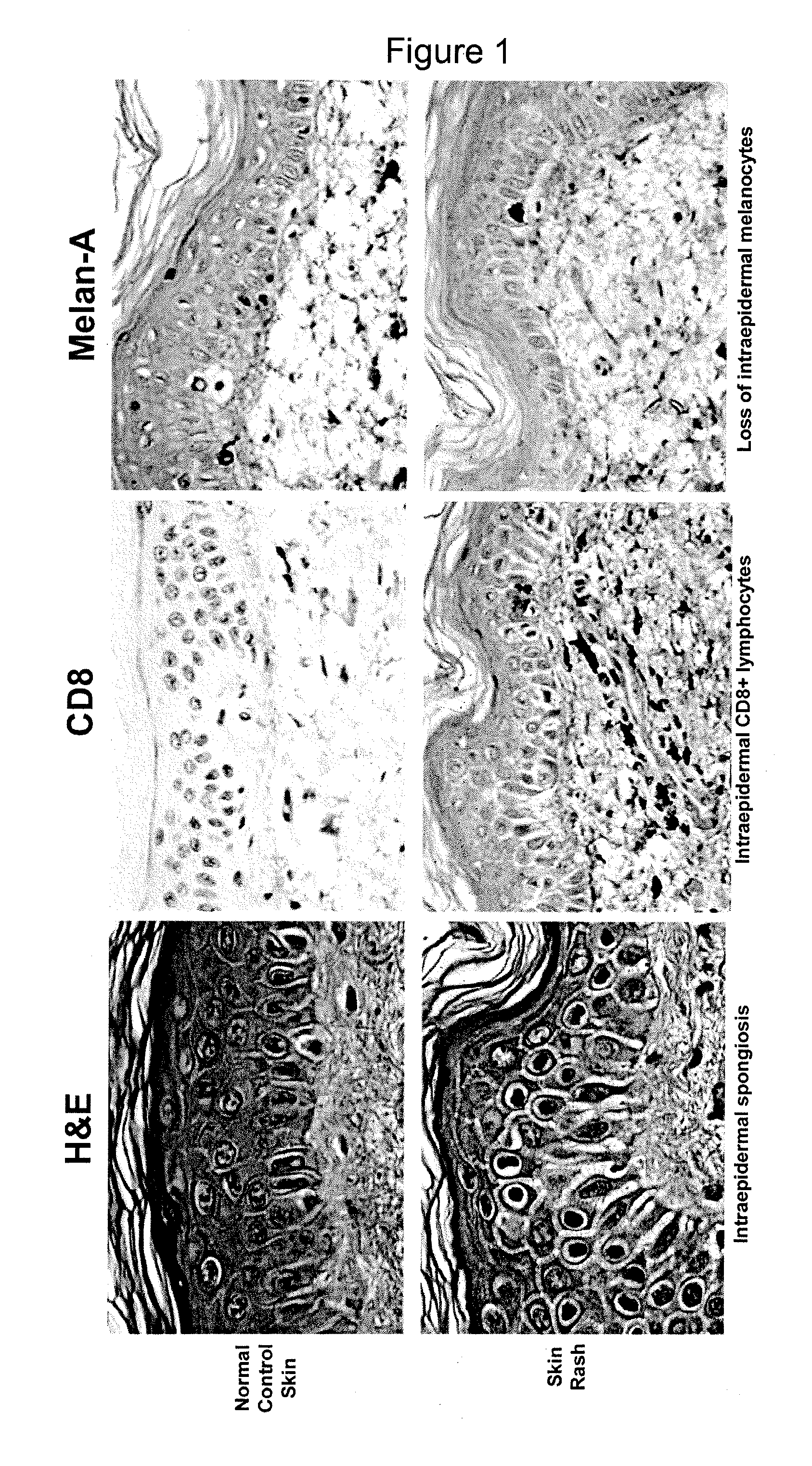 Methods of identifying central memory t cells and obtaining antigen-specific t cell populations