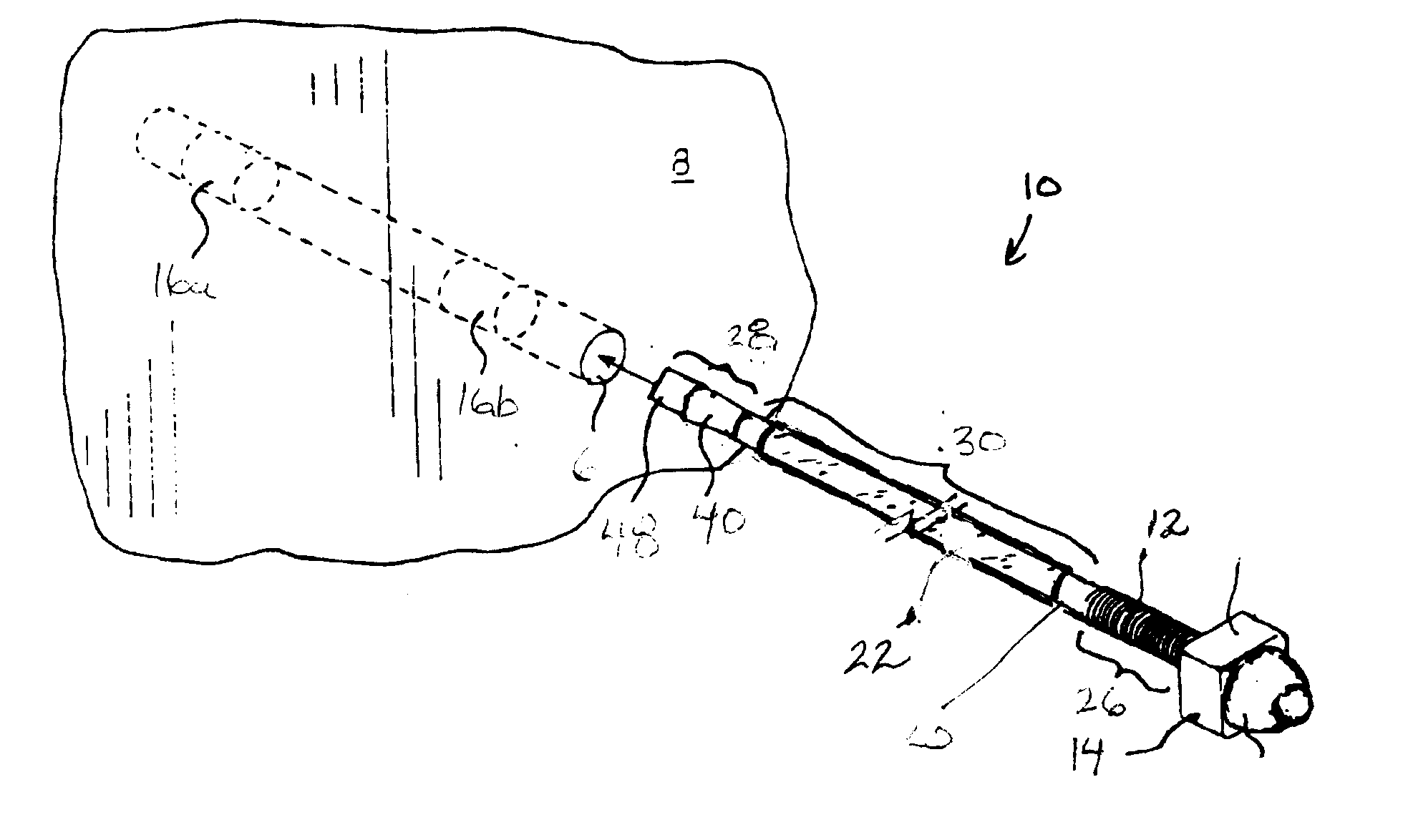 Yieldable cone bolt and method of manufacturing same